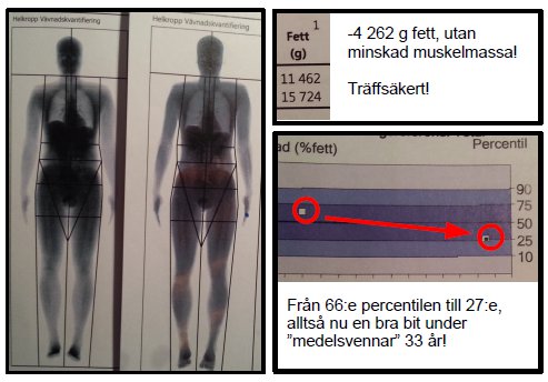 iDXA_vavnadskvantifiering130314